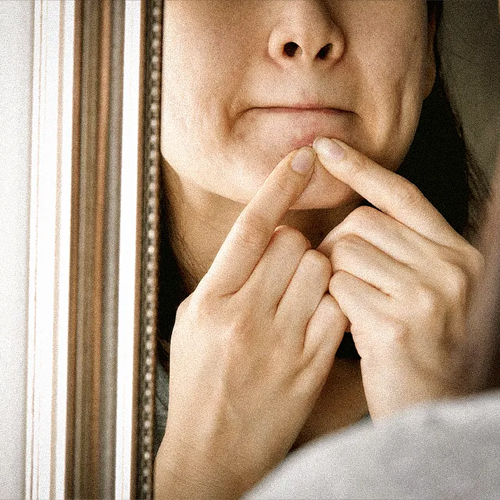 چه مواد غذایی باعث جوش صورت میشود؟