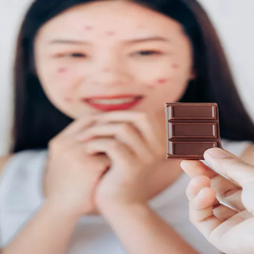 چه مواد غذایی باعث جوش صورت میشود